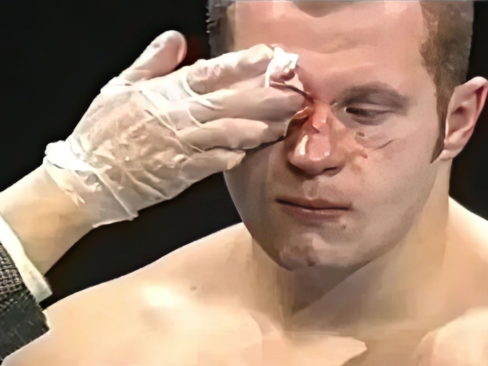 Fedor emelianenko vs tsuyoshi kosaka